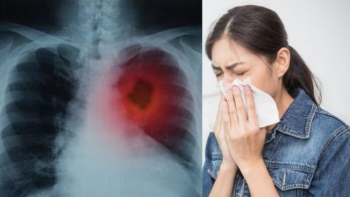 देशभर में फैला H3N2 वायरस का कहर, फ्लू जैसे लक्षणों से जूझ रहे 70% घरों में एक से अधिक बीमार देशभर में फैला H3N2 वायरस का कहर, फ्लू जैसे लक्षणों से जूझ रहे 70% घरों में एक से अधिक बीमार